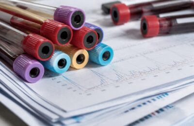 Cătălin Rizea spune că a cheltuit cu Adda aproximativ 15.000 de euro pe analize de sânge