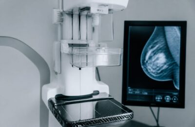 Mortalitatea provocată de cancer a scăzut de la 201 la 142 de decese la 100.000 de locuitori în SUA