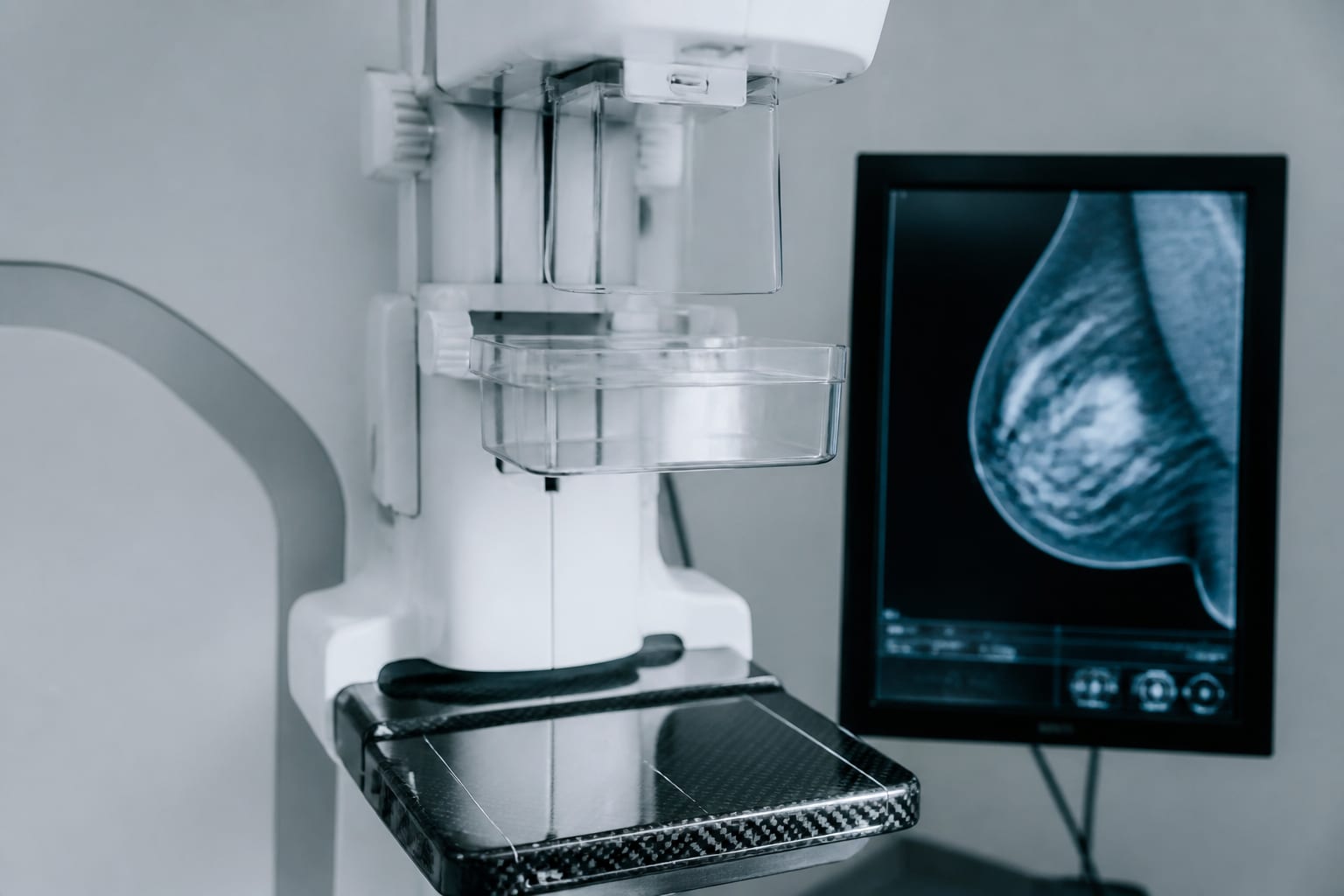 Mortalitatea provocată de cancer a scăzut de la 201 la 142 de decese la 100.000 de locuitori în SUA
