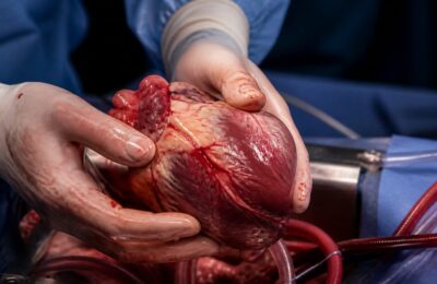 Primul transplant de inimă la Institutul de Boli Cardiovasculare din Iași a salvat un pacient de 44 de ani