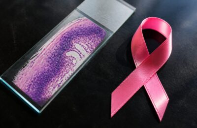 Semnele cancerului de col uterin pot apărea târziu, iar sângerările anormale sunt printre principalele alerte