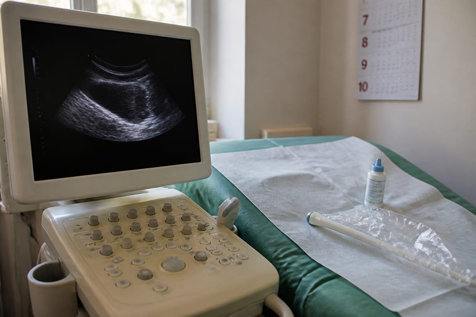 Diagnosticarea endometriozei durează până la 10 ani pentru că durerea menstruală severă e considerată normală
