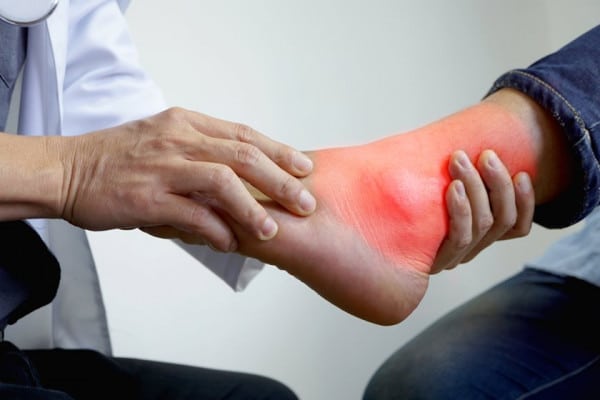 Dureri ale gleznei si piciorului | Cauze, simptome si tratamente – Voltaren